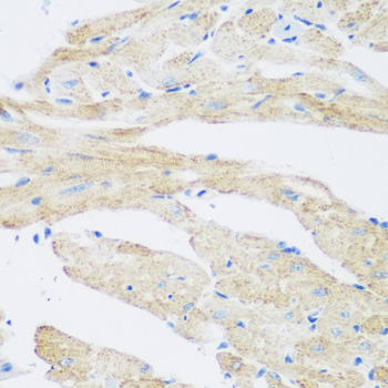 Immunohistochemistry - NAT8B Polyclonal Antibody 