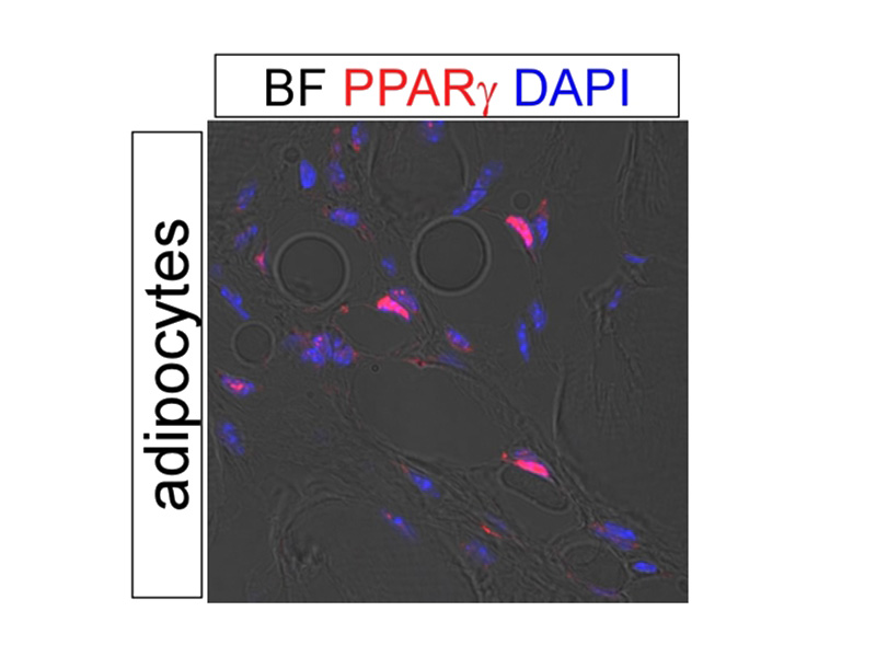 IF result of anti-PPARg (Catalog No:114082, 1:500) with PFA fixed mouse adipose tissue by Dr. Daniel Kopinke.