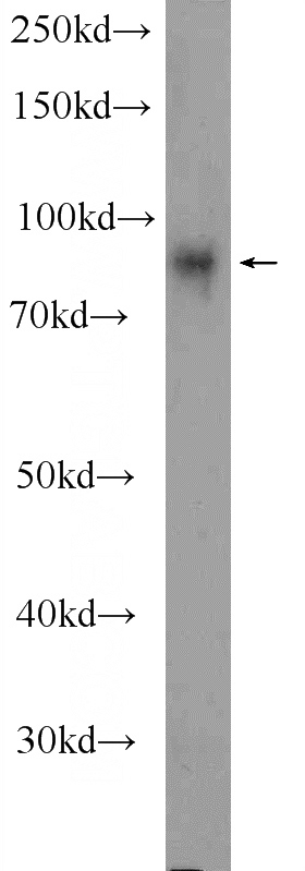 mouse heart tissue were subjected to SDS PAGE followed by western blot with Catalog No:116261(TPCN1 Antibody) at dilution of 1:300