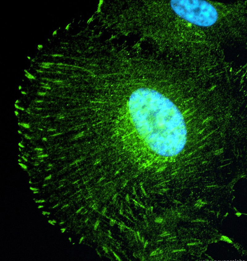 IF Result of anti-NPHP5 (Catalog No:113215,1:50) show 'focal adhesion-like' structures in human hTERT-RPE1 cells by Dr. Moshe Kim. 1% PFA fixation.