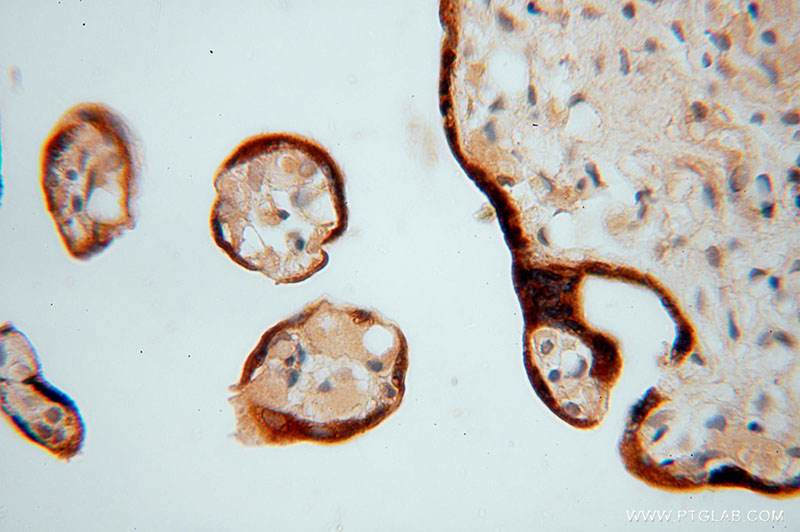 Immunohistochemical of paraffin-embedded human placenta using Catalog No:113612(SPK antibody) at dilution of 1:100 (under 40x lens)