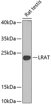 Western blot - LRAT Polyclonal Antibody 