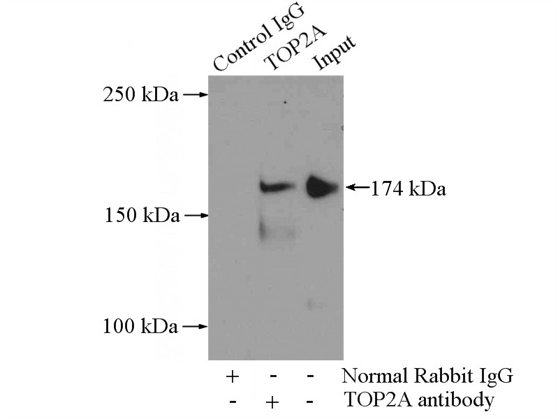IP Result of anti-TOP2A-Specific (IP:Catalog No:116247, 4ug; Detection:Catalog No:116247 1:500) with HeLa cells lysate 2000ug.