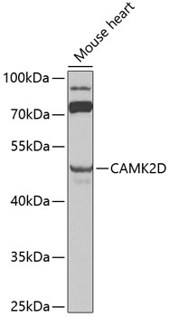 Western blot - CAMK2D Polyclonal Antibody 
