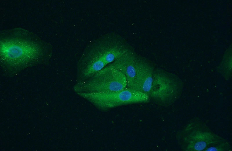 Immunofluorescent analysis of A549 cells using Catalog No:114358(PYGB Antibody) at dilution of 1:50 and Alexa Fluor 488-congugated AffiniPure Goat Anti-Rabbit IgG(H+L)