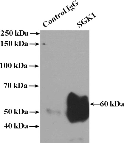 IP Result of anti-SGK1 (IP:Catalog No:115166, 4ug; Detection:Catalog No:115166 1:600) with HEK-293 cells lysate 1480ug.