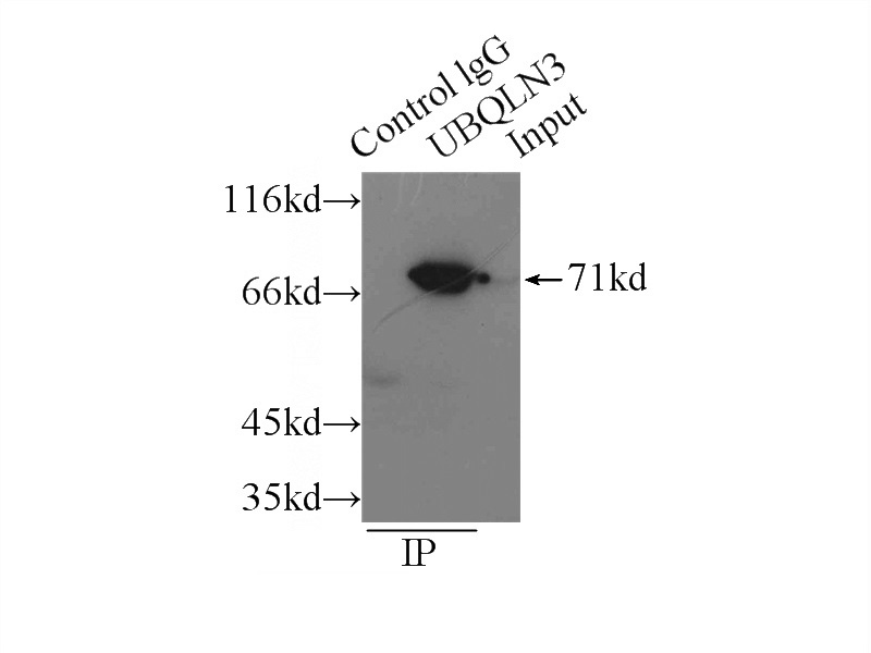 IP Result of anti-Ubiquilin 3 (IP:Catalog No:116659, 4ug; Detection:Catalog No:116659 1:800) with mouse testis tissue lysate 6000ug.