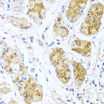 Immunohistochemistry - Endothelin 1 Polyclonal Antibody 