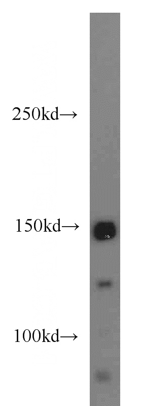 mouse brain tissue were subjected to SDS PAGE followed by western blot with Catalog No:116682(USP42 antibody) at dilution of 1:300
