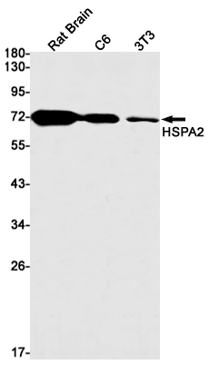 Western blot detection of HSPA2 in Rat Brain,C6,3T3 cell lysates using HSPA2 Rabbit mAb(1:1000 diluted).Predicted band size:70kDa.Observed band size:70kDa.