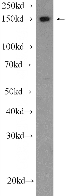 mouse testis tissue were subjected to SDS PAGE followed by western blot with Catalog No:111664(IFT140 Antibody) at dilution of 1:300