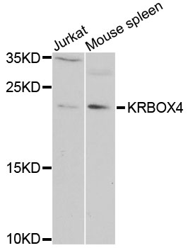 Western blot - KRBOX4 Polyclonal Antibody 