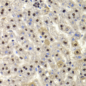 Immunohistochemistry - HIRIP3 Polyclonal Antibody 