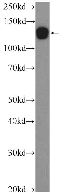 rat brain tissue were subjected to SDS PAGE followed by western blot with Catalog No:109152(CDH10-specific Antibody) at dilution of 1:1000