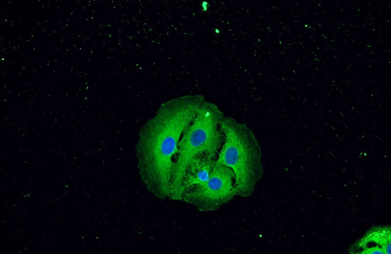 Immunofluorescent analysis of SH-SY5Y cells using Catalog No:116034(TH Antibody) at dilution of 1:50 and Alexa Fluor 488-congugated AffiniPure Goat Anti-Rabbit IgG(H+L)