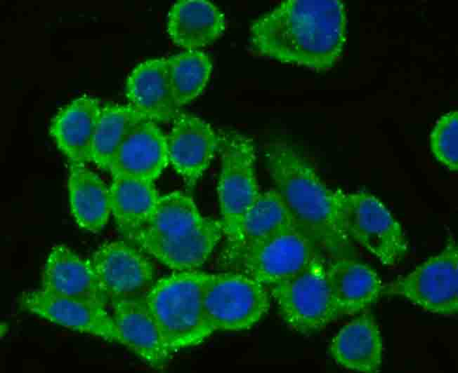 Fig4: ICC staining CD130 (green) in LOVO cells. The nuclear counter stain is DAPI (blue). Cells were fixed in paraformaldehyde, permeabilised with 0.25% Triton X100/PBS.