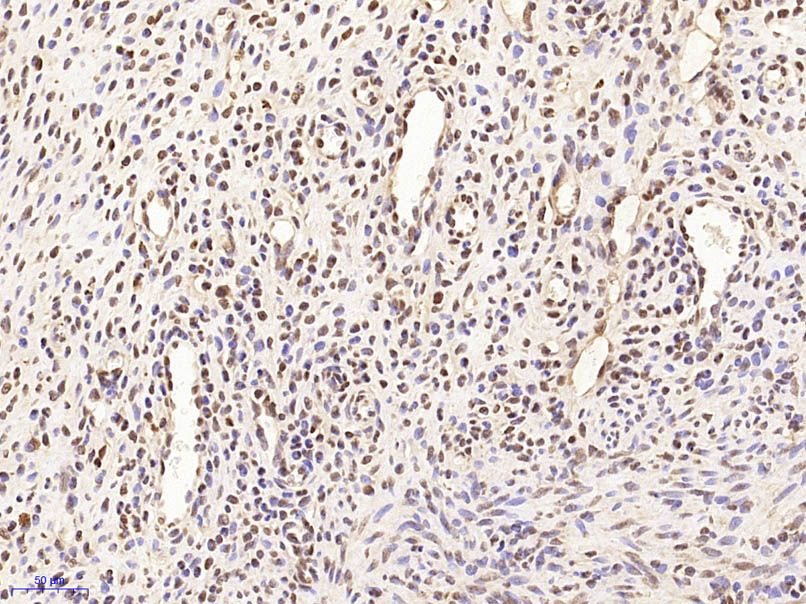 Fig1: Paraformaldehyde-fixed, paraffin embedded (Rat uterus); Antigen retrieval by microwave in sodium citrate buffer (pH6.0) ; Block endogenous peroxidase by 3% hydrogen peroxide for 30 minutes; Blocking buffer (3% BSA) at RT for 30min; Antibody incubation with (MARCH7) Polyclonal Antibody, Unconjugated at 1:400 overnight at 4℃, followed by conjugation to the secondary antibody (labeled with HRP)and DAB staining.