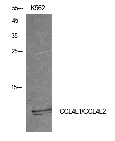 Fig1:; Western Blot analysis of K562 cells using MIP-1b Polyclonal Antibody. Antibody was diluted at 1:500. Secondary antibody（catalog#: HA1001) was diluted at 1:20000
