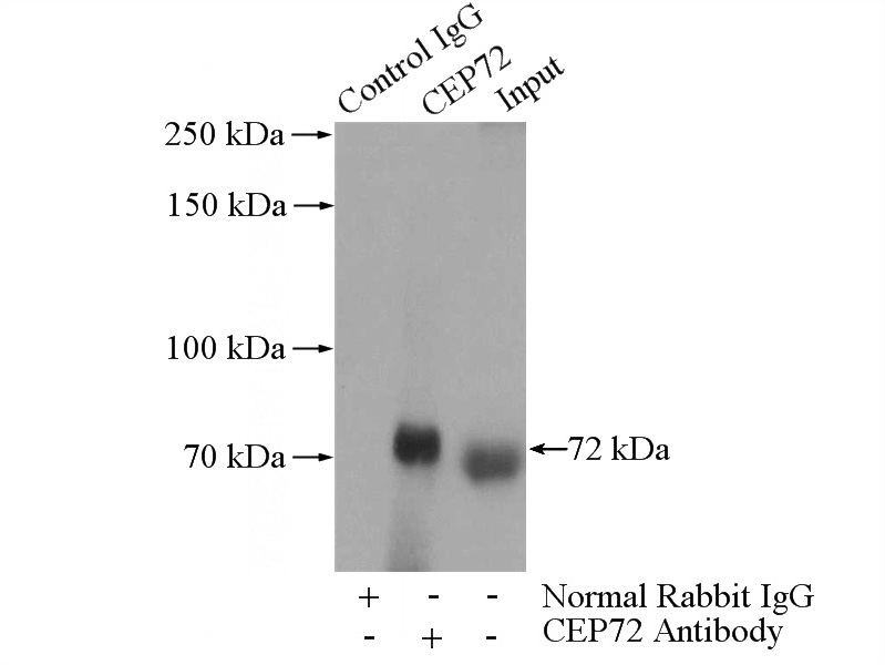 IP Result of anti-CEP72 (IP:Catalog No:109186, 4ug; Detection:Catalog No:109186 1:1000) with HeLa cells lysate 520ug.