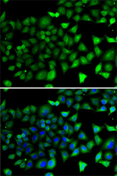 Immunofluorescence - NFYB Polyclonal Antibody 