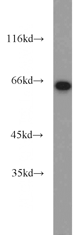 mouse heart tissue were subjected to SDS PAGE followed by western blot with Catalog No:113789(PGM1 antibody) at dilution of 1:1000