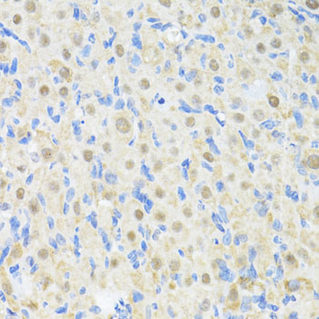 Immunohistochemistry - PRKAG2 Polyclonal Antibody 