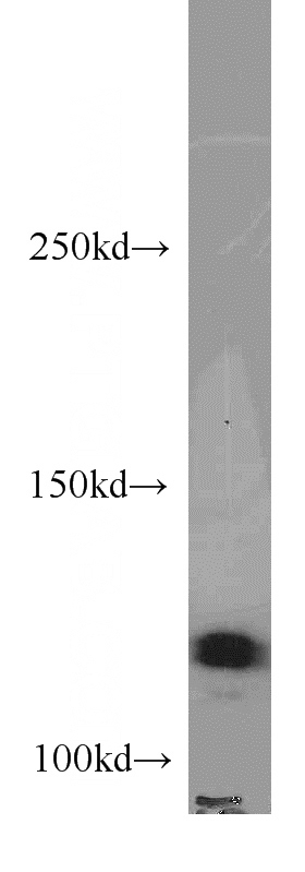 HeLa cells were subjected to SDS PAGE followed by western blot with Catalog No:113951(PLD1 antibody) at dilution of 1:500