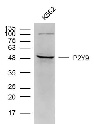 Fig2: Sample: k562 (human)cell Lysate at 40 ug; Primary: Anti- P2Y9 at 1/300 dilution; Secondary: IRDye800CW Goat Anti-Rabbit IgG at 1/20000 dilution; Predicted band size: 42 kD; Observed band size: 48 kD