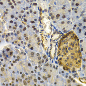 Immunohistochemistry - UBD Polyclonal Antibody 