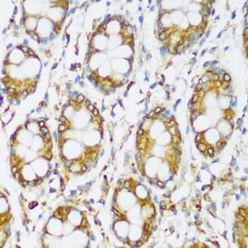 Immunohistochemistry - ERLIN1 Polyclonal Antibody 