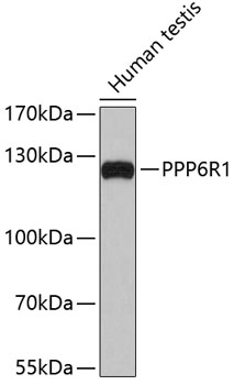 Western blot - PPP6R1 Polyclonal Antibody 