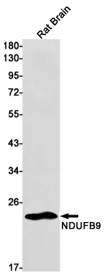 Western blot detection of NDUFB9 in Rat Brain lysates using NDUFB9 Rabbit mAb(1:1000 diluted).Predicted band size:22kDa.Observed band size:22kDa.