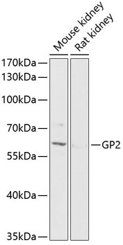 Western blot - GP2 Polyclonal Antibody 