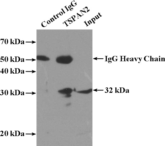 IP Result of anti-TSPAN2 (IP:Catalog No:116447, 4ug; Detection:Catalog No:116447 1:500) with HL-60 cells lysate 960ug.