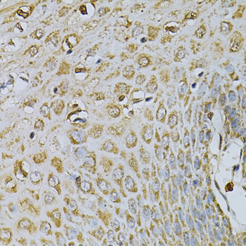 Immunohistochemistry - CDA Polyclonal Antibody 