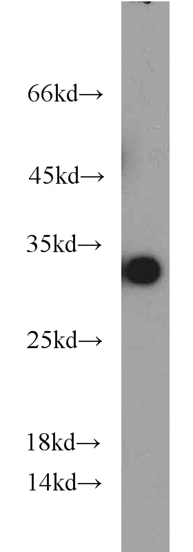 human brain tissue were subjected to SDS PAGE followed by western blot with Catalog No:107550(14-3-3 antibody) at dilution of 1:1000