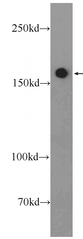 A549 cells were subjected to SDS PAGE followed by western blot with Catalog No:110725(FMN1 Antibody) at dilution of 1:600