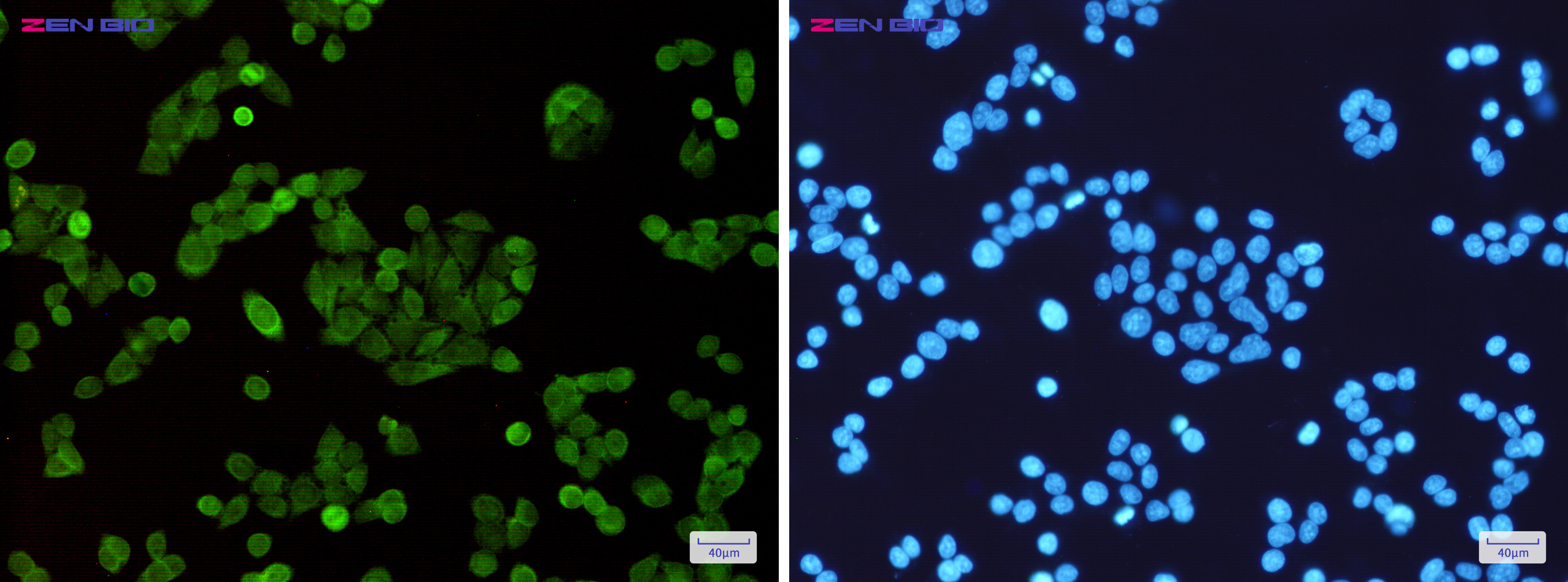 Immunocytochemistry of STAT5A/B(green) in Hela cells using STAT5A/B Rabbit mAb at dilution 1/50, and DAPI(blue)