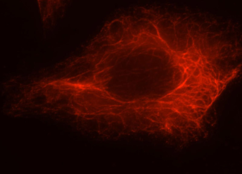 Immunofluorescent analysis of Hela cells, using LENG9 antibody Catalog No:112195 at 1:25 dilution and Rhodamine-labeled goat anti-rabbit IgG (red).