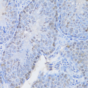 Immunohistochemistry - CBX8 Polyclonal Antibody 