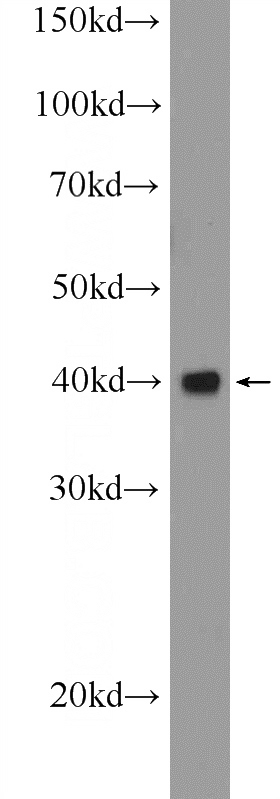SH-SY5Y cells were subjected to SDS PAGE followed by western blot with Catalog No:110549(FBXO2 Antibody) at dilution of 1:300