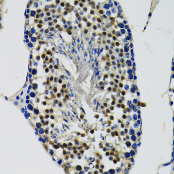 Immunohistochemistry - DDX41 Polyclonal Antibody 