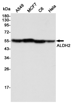 Western blot detection of ALDH2 in A549,MCF7,C6 and Hela cell lysates using ALDH2 mouse mAb (1:3000 diluted).Predicted band size:56KDa.Observed band size:56KDa.