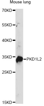 Western blot - PKD1L2 Polyclonal Antibody 