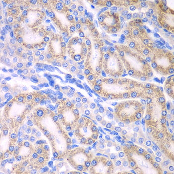 Immunohistochemistry - ALDH1A2 Polyclonal Antibody 