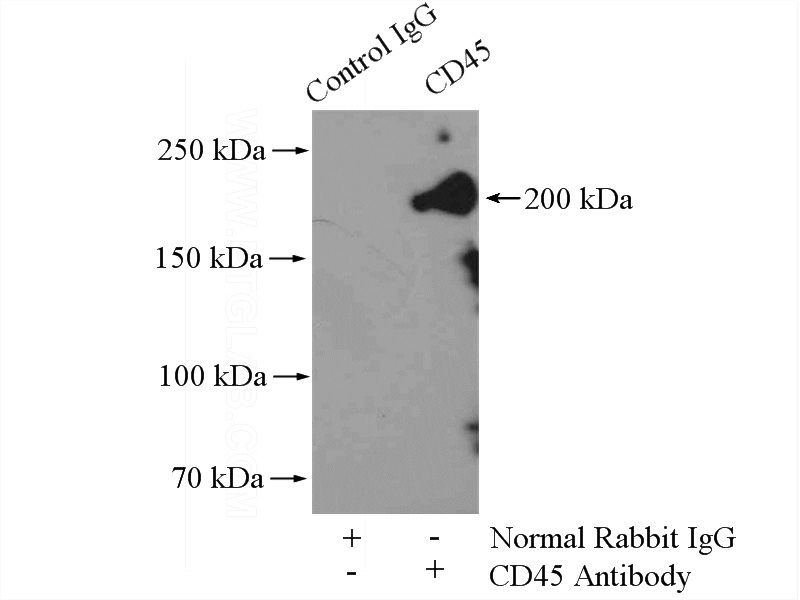 IP Result of anti-CD45 (IP:Catalog No:109125, 4ug; Detection:Catalog No:109125 1:300) with mouse spleen tissue lysate 4800ug.