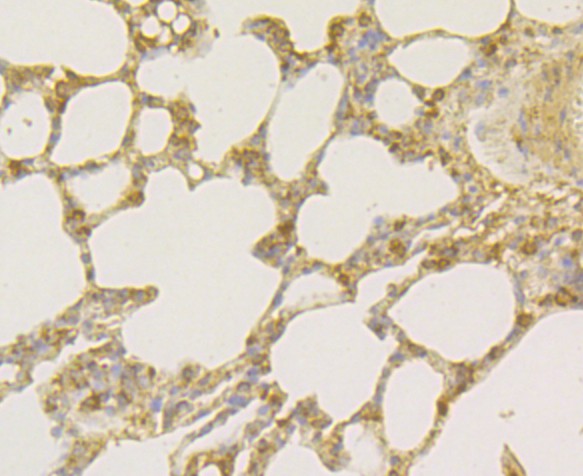Fig5: Immunohistochemical analysis of paraffin-embedded rat lung tissue using anti-Osteoprotegerin antibody. Counter stained with hematoxylin.