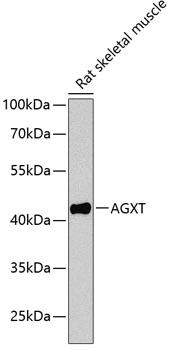 Western blot - AGXT Polyclonal Antibody 