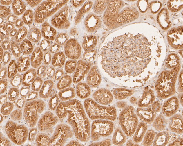 Fig4:; Immunohistochemical analysis of paraffin-embedded human kidney tissue using anti-DNA2 antibody. The section was pre-treated using heat mediated antigen retrieval with sodium citrate buffer (pH 6.0) for 20 minutes. The tissues were blocked in 5% BSA for 30 minutes at room temperature, washed with ddH; 2; O and PBS, and then probed with the primary antibody ( 1/400) for 30 minutes at room temperature. The detection was performed using an HRP conjugated compact polymer system. DAB was used as the chromogen. Tissues were counterstained with hematoxylin and mounted with DPX.