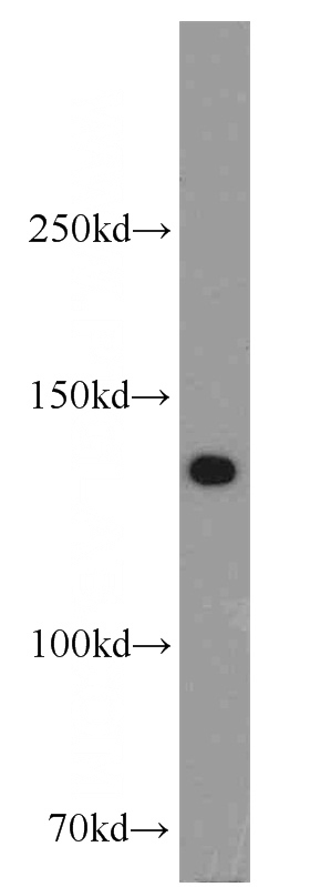 mouse testis tissue were subjected to SDS PAGE followed by western blot with Catalog No:108553(BUB1B antibody) at dilution of 1:500